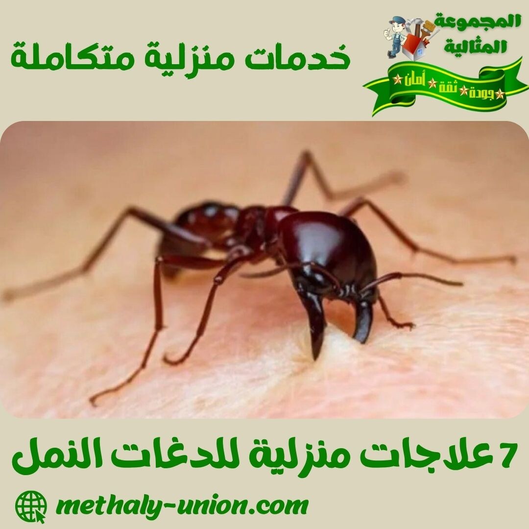 7 علاجات منزلية للدغات النمل